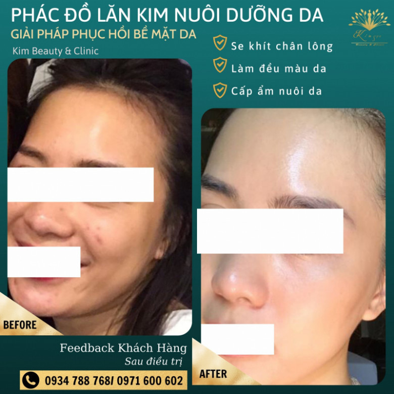 Kim Spa - Quận 5, Hồ Chí Minh
