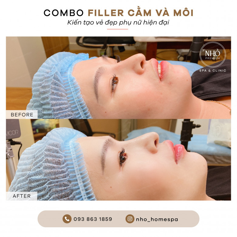 Nhỏ Premium Spa - Quận 9, Hồ Chí Minh
