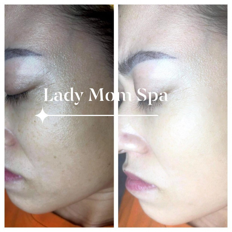 Lady Mom Spa - Quận 9, Hồ Chí Minh