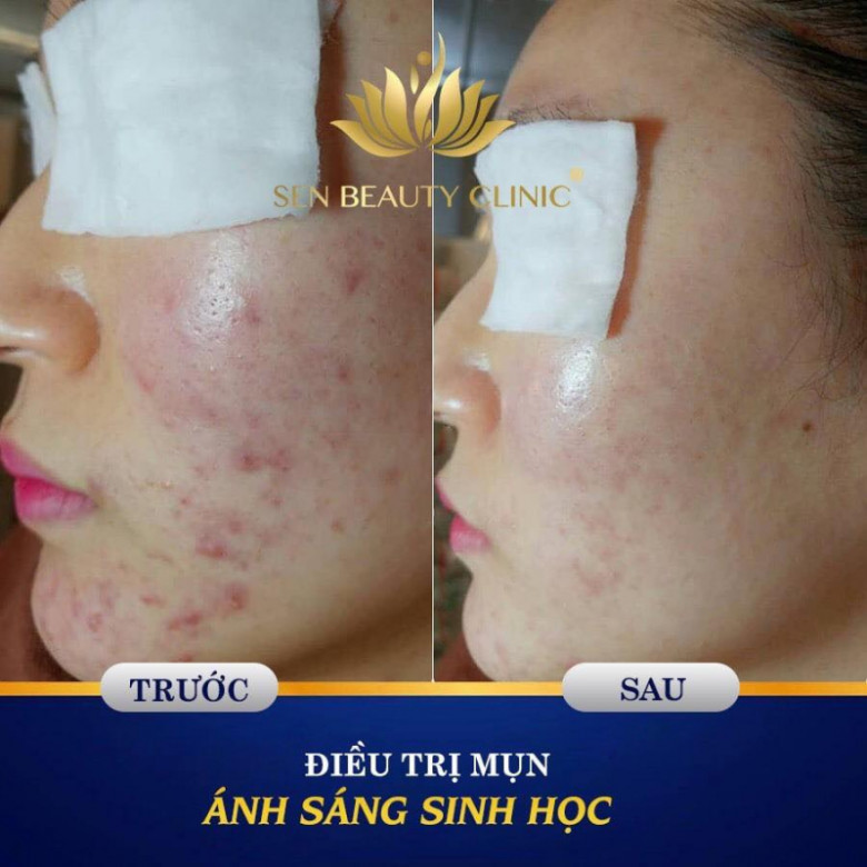 Sen River Spa - MedicalSpa - Quận Bình Thạnh, Hồ Chí Minh