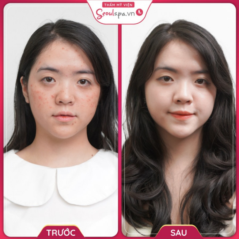 Seoul Spa - Quận Gò Vấp, Hồ Chí Minh