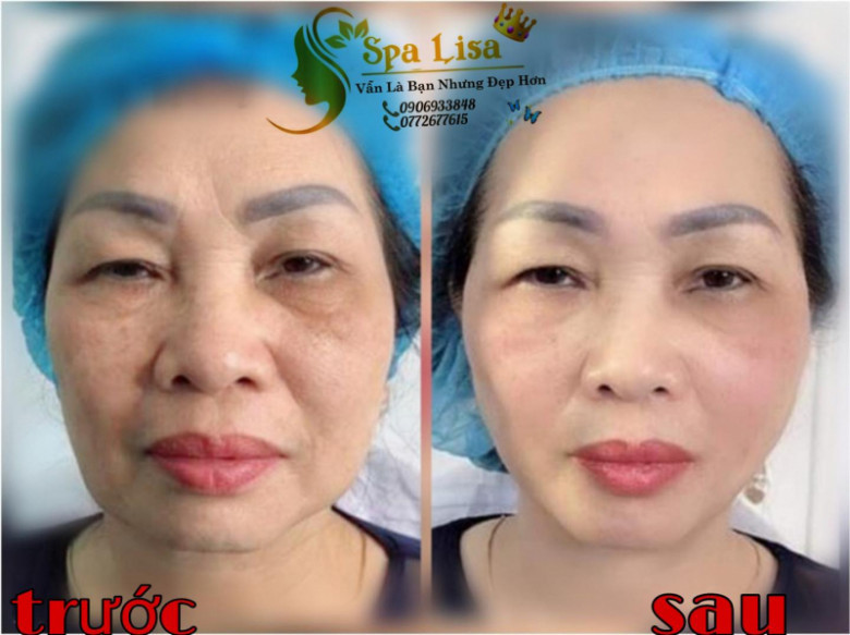 Spa LiSa - Quận Gò Vấp, Hồ Chí Minh