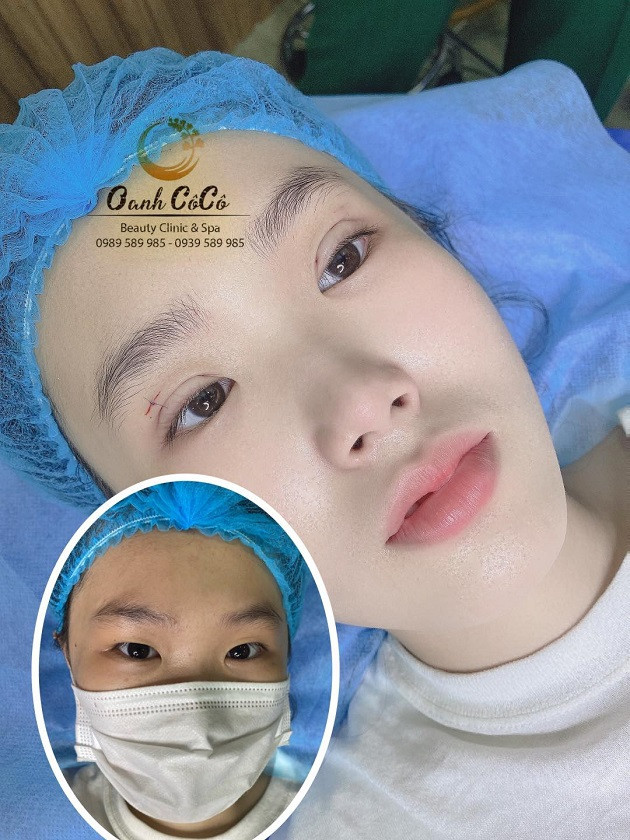 Oanh CôCô Beauty Clinic and Spa - Quận Tân Phú, Hồ Chí Minh