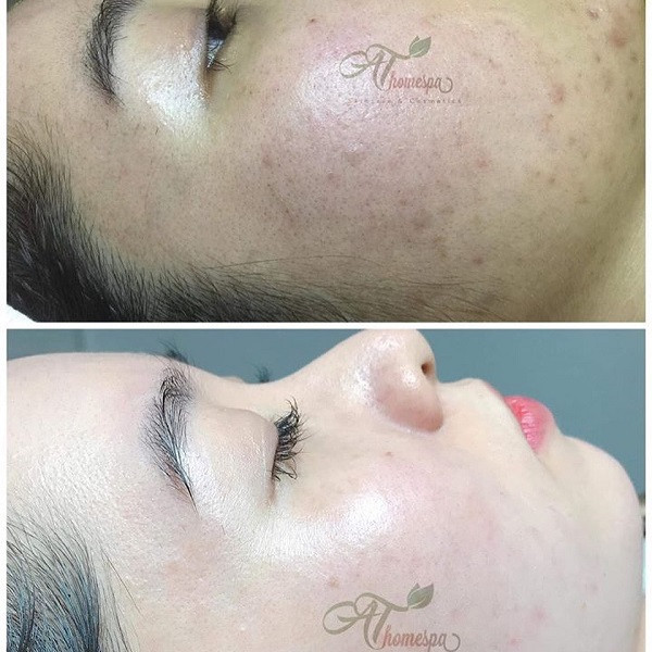 Spa chăm sóc da Uyên Thuỳ - Hóc Môn, Hồ Chí Minh