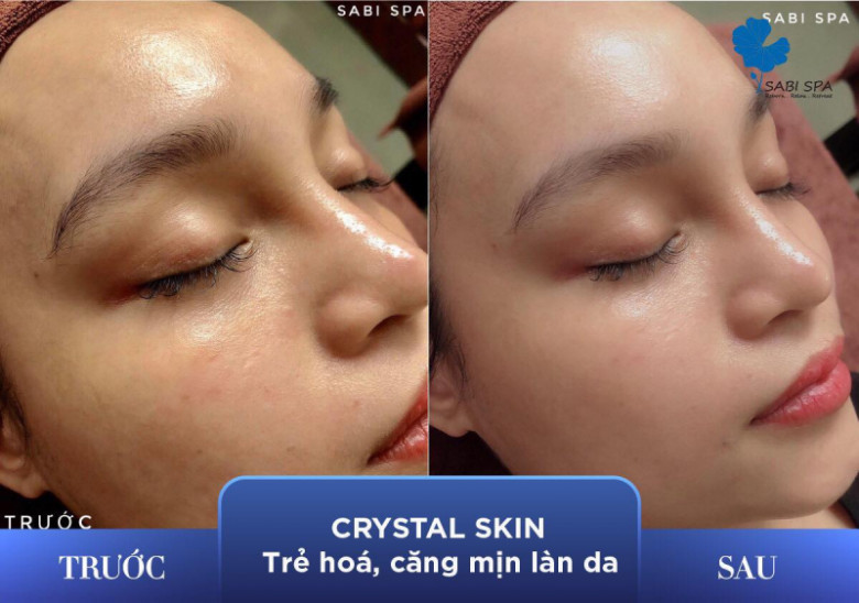 Sabi Spa - Quận Hoàn Kiếm, Hà Nội