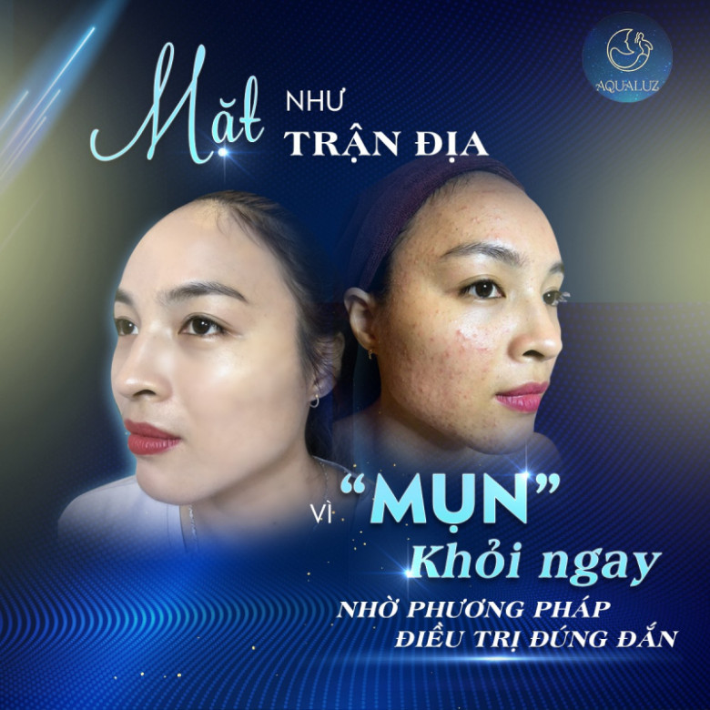 Thẩm Mỹ Công Nghệ Cao Aqualuz - Quận Hoàn Kiếm, Hà Nội