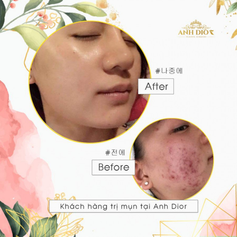 AnhDior Beauty - Quận Hoàn Kiếm, Hà Nội