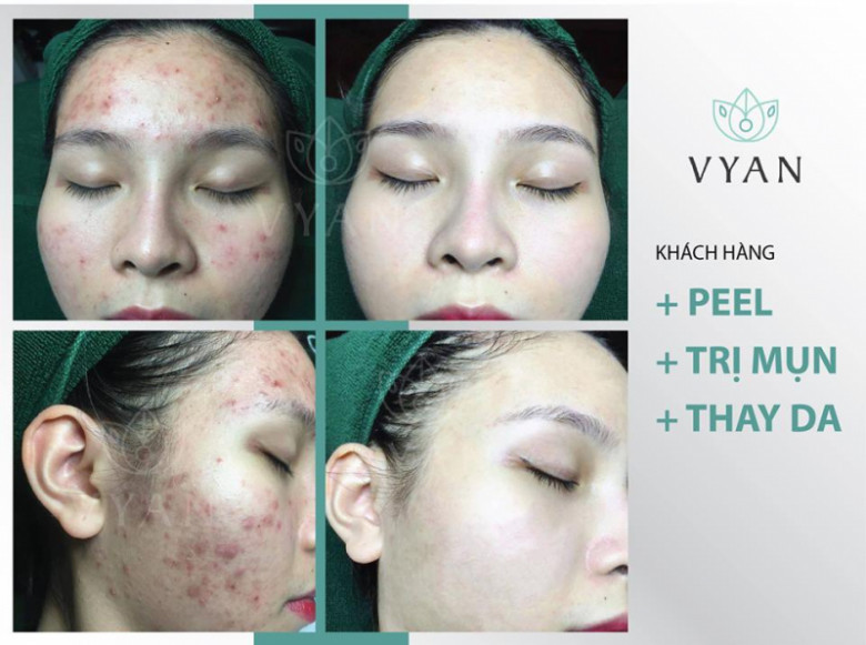 Vy An Spa - Quận Hoàn Kiếm, Hà Nội
