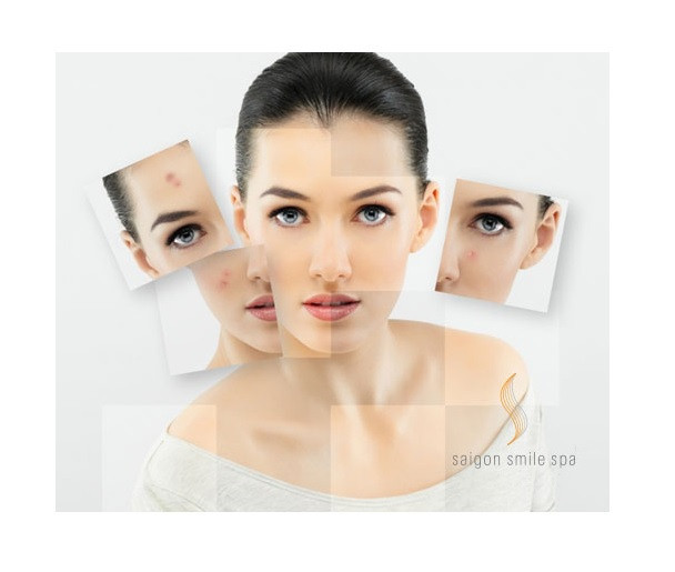 Saigon Smile Spa - Quận Hoàn Kiếm, Hà Nội