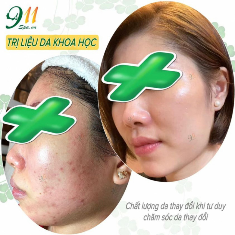 911 Beauty SPA - Quận Long Biên, Hà Nội