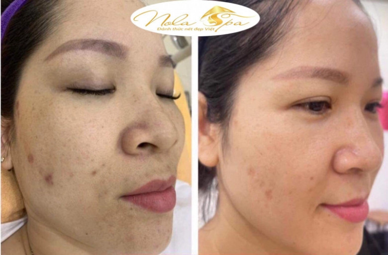 Thu Hoài Spa - Quận Bắc Từ Liêm, Hà Nội
