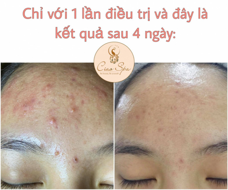 Ciao Spa - Quận Ba Đình, Hà Nội