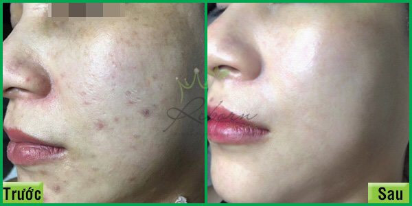 Reborn Skin Clinic - Quận Ba Đình, Hà Nội