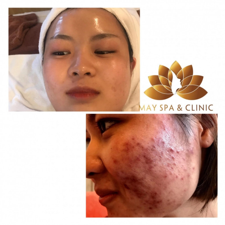 May Spa Clinic - Hoài Đức, Hà Nội