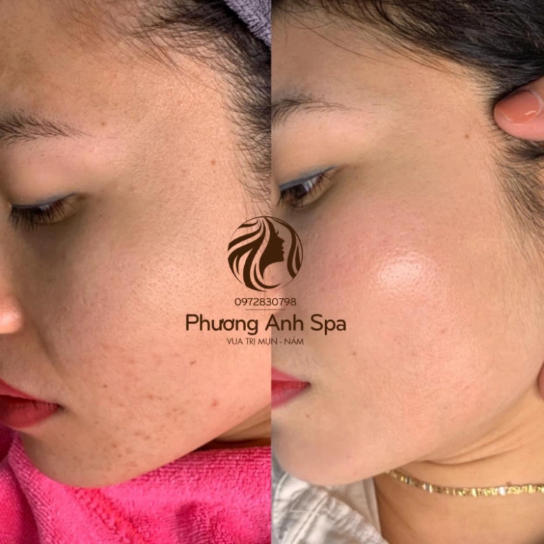 Phương Anh Spa - Mê Linh, Hà Nội